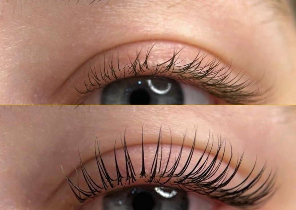 Kirpik Lifting öncesi ve sonrası – By Nur Rana Klinik, Karatay/Konya